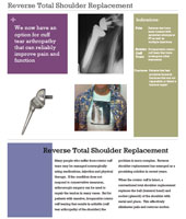 Shoulder Replacement | Shoulder Arthroscopy | Rotator Cuff Repair | Los Angeles CA | Van Nuys CA